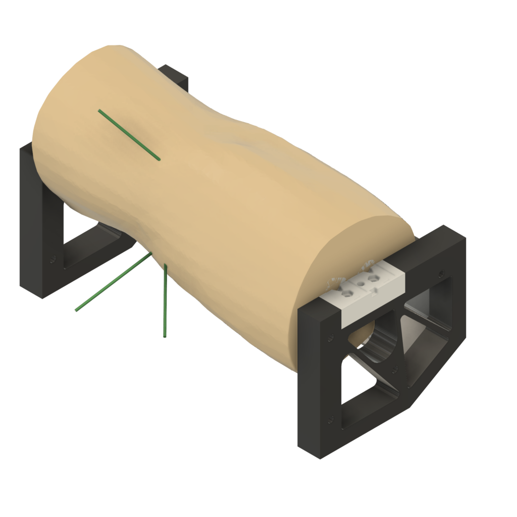 3D elbow model with K-wires showing anatomical detail